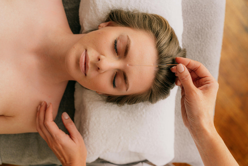 Esthétique et acupuncture